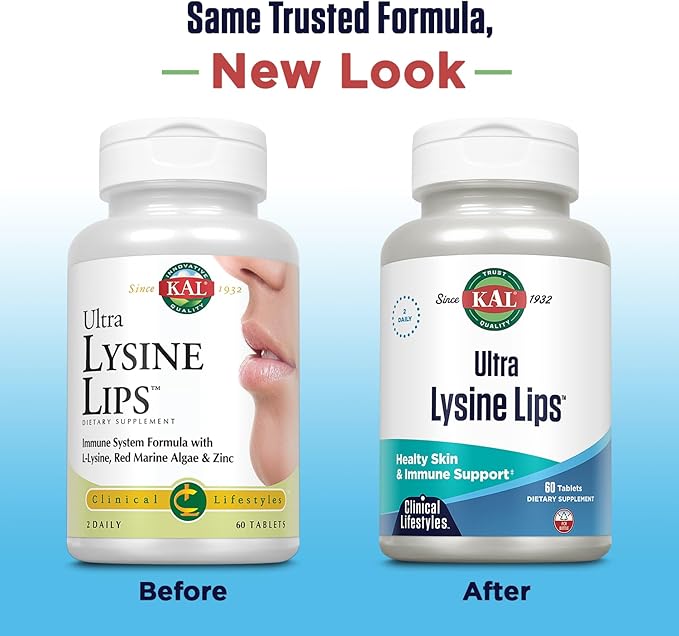 Kal Ultra Lysine Lips Tablets, 60 Count
