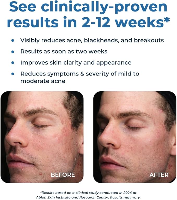 VitaMedica Clear Skin Vitamin Formula | Noncystic Acne Supplement for Skin Clearing | Breakout Treatment for Women and Men | Vitamins A, C, E, Selenium, Chromium, and Zinc for Skin Health | 2 Pack