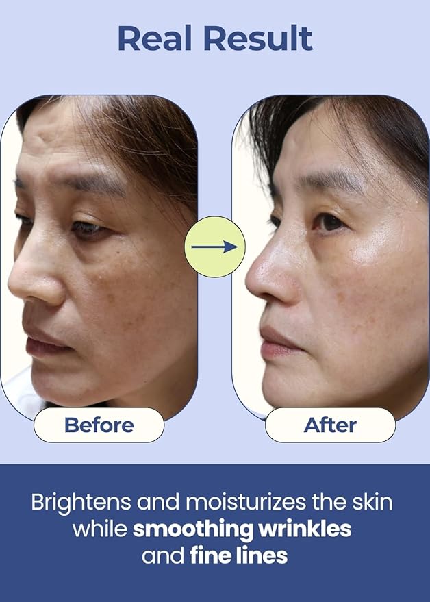 Overnight Wrinkle Patches for Face - Premium Korean Face Lift Tape with Collagen & Peptides - Anti Wrinkle Tape for Frown & Smile Lines, Forehead, Eyes, Crow’s Feet | 50 Count