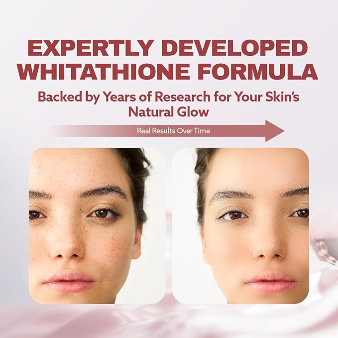 ILO Whitathione – Glutathione + White Tomato Antioxidant Powder with Vitamin C & E | Daily Glow Support | 30 Convenient Stick Packs