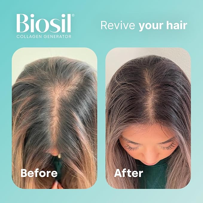 Biosil Collagen Generator - 0.5 fl oz Drops - With Patented ch-OSA Complex - Generates & Protects Your Own Collagen - GMO Free - 30-Day Supply