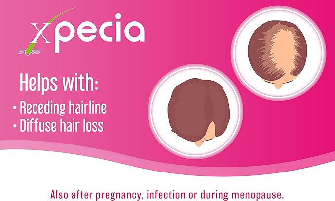 FOR WOMEN ANTI HAIR LOSS & DHT BLOCKER & NEW HAIR GROWTH FORMULA (60 Tablets)