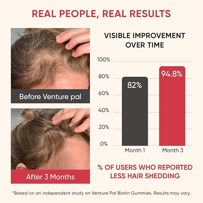 Venture Pal Biotin Gummies with Collagen & Keratin - Hair Growth Support Skin and Nail Strength Vitamins for Women & Men - Biotin 10000mcg | B-Complex | Saw Palmetto - Sugar Free, Non-GMO, 60ct