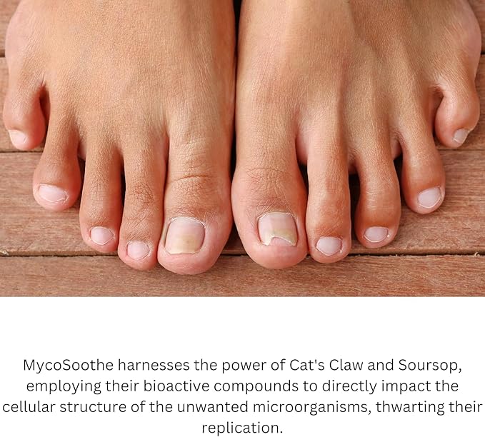 MycoSoothe Advanced Hair, Skin, Nail & Immunity Support Formula - 2 Pack