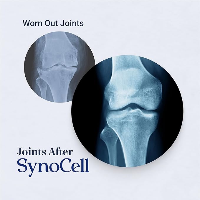 Glucosamine Chondroitin Complex Back, Neck, and Joint Support Supplement with Boswellia, Quercetin, & MSM - Renew Your Joints from The Inside Out - Move with Freedom and Ease