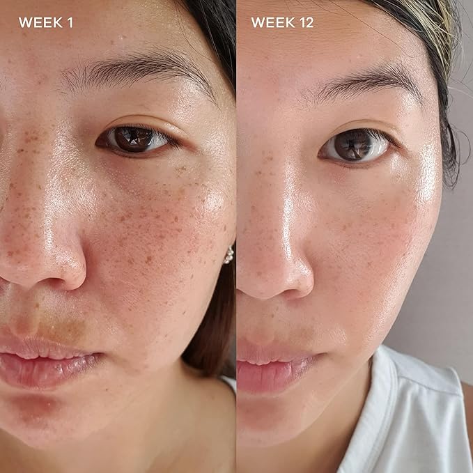 Vida Glow Radiance Supplement Capsules - Anti Aging Supplement - Targeting Dark Spots, Uneven Skin Tone, Redness Relief - Promotes Glowing Skin | 30 Servings
