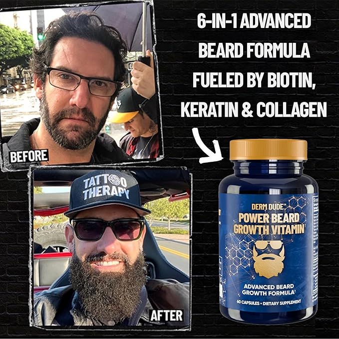 Derm Dude Power Beard Growth Vitamins for Men | With Biotin 10K MCG, Zinc B12 Saw Palmetto & Keratin for Healthier Thicker Fuller & Stronger Facial Hair | Restore Hair Breakage & Thinning, 60 Capsules