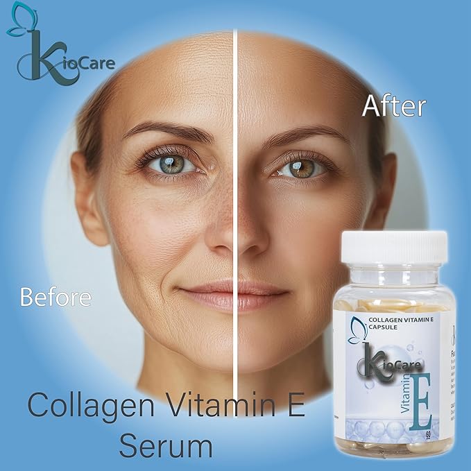 KIOCARE-Vitamin E Oil for Face-Skin Care,Vitamin E Oil-Vitamin E Capsules-Facial Skin Care Products-Face Serum-Face Care-Vitamina E para la Cara-Anti Aging-Aloe Vera-Face Oil and Serum for Women