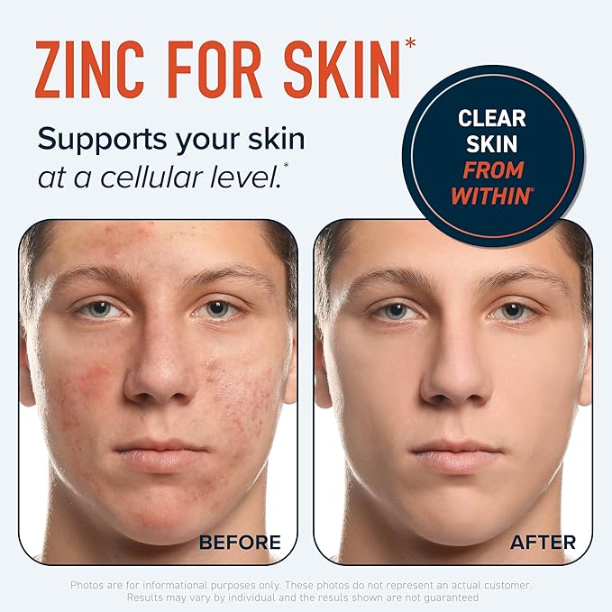 Zinc Supplement Microbeadlets for Immune & Acne Support | Highly Absorbable Zinc Bisglycinate & Orotate with 2mg Chelated Copper + Vitamin B6 | Vegan, Gluten-Free | 60 Capsules (2 Month Supply)