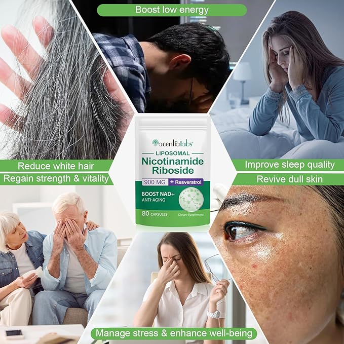NAD+ Supplement for Women - NMN Alternative with -Liposomal NAD with Resveratrol - High Purity NAD Supplement for Anti-Aging, Energy, Focus - 80 Capsules