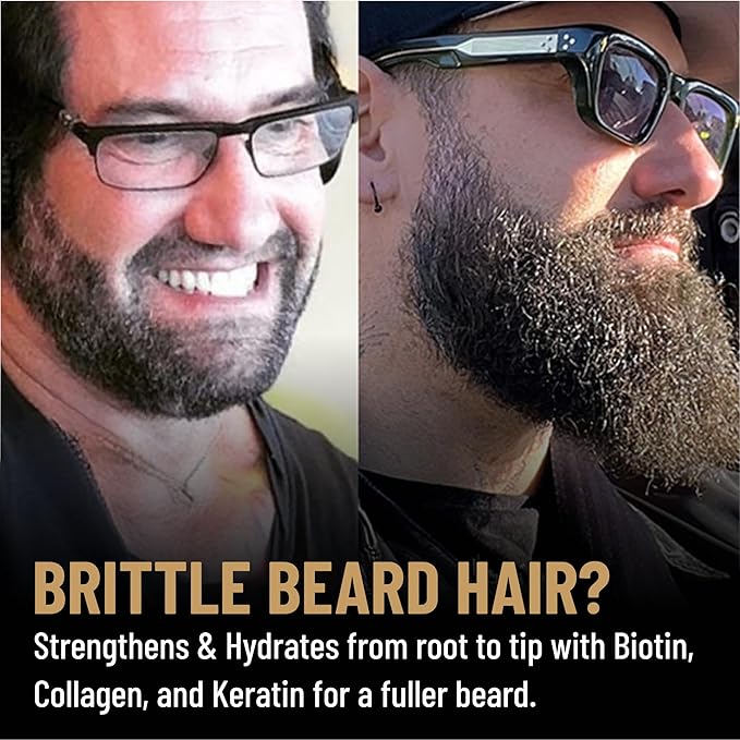 Derm Dude Power Beard Growth Vitamins for Men | With Biotin 10K MCG, Zinc B12 Saw Palmetto & Keratin for Healthier Thicker Fuller & Stronger Facial Hair | Restore Hair Breakage & Thinning, 60 Capsules