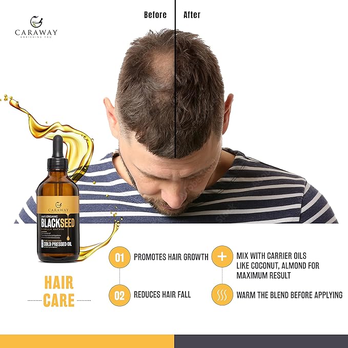 CARAWAY Black Cumin Seed Oil – Cold Pressed Black Seed Oil rich in Thymoquinone – Immunity Booster – Hair Care – Glass Bottle – 8 oz / 236 ml