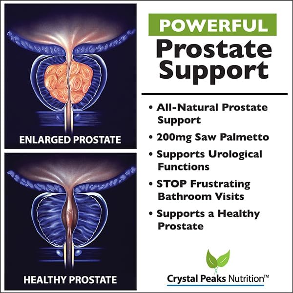 Extra Strength Prostate Support Supplement - Less Urgency, Fewer Nighttime Bathroom Visits. Beta-Sitosterol, Saw Palmetto Plus 28 Additional Prostate nutrients - 60 Capsules