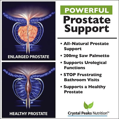 Extra Strength Prostate Support Supplement - Less Urgency, Fewer Nighttime Bathroom Visits. Beta-Sitosterol, Saw Palmetto Plus 28 Additional Prostate nutrients - 60 Capsules