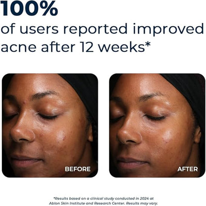 VitaMedica Clear Skin Vitamin Formula | Noncystic Acne Supplement for Skin Clearing | Breakout Treatment for Women and Men | Vitamins A, C, E, Selenium, Chromium, and Zinc for Skin Health | 2 Pack