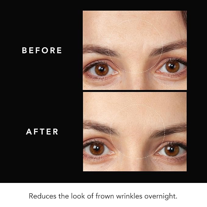 FAQ Hyaluronic Acid Patches For Forehead - Forehead Patches - Travel -friendly Skin Care - 3 pcs.