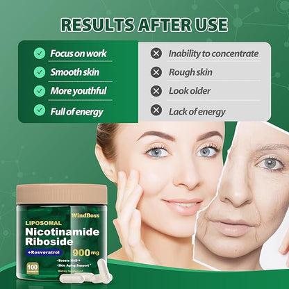 NAD Nicotinamide Riboside Resveratrol, Liposomal NAD Supplements for Women & Men, NMN Supplement Alternative, NAD Supplement - 100 Capsules - 4pcs