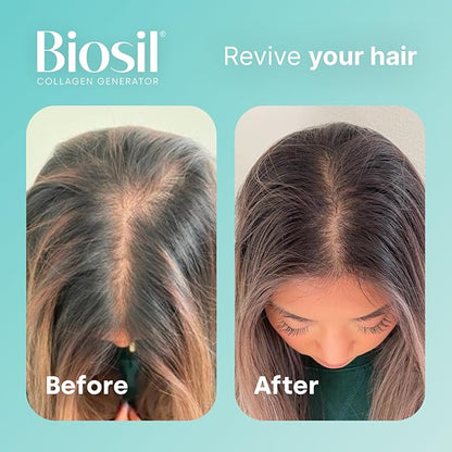 Biosil Collagen Generator - 0.5 fl oz Drops - With Patented ch-OSA Complex - Generates & Protects Your Own Collagen - GMO Free - 30-Day Supply