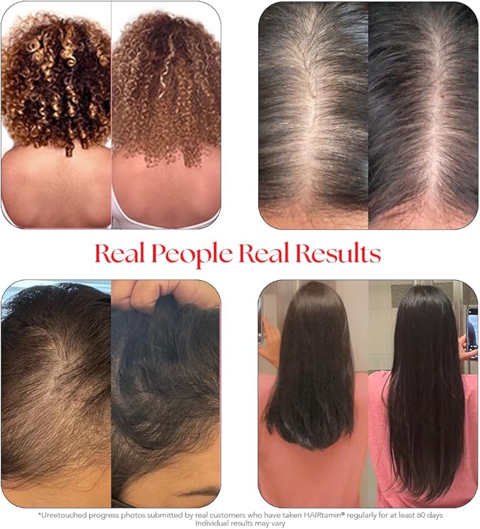 HAIRtamin Advanced Hair & Scalp Serum Pack | All-Natural Vegan Biotin Capsules & Serum Sample for Hair, Skin & Nail Growth