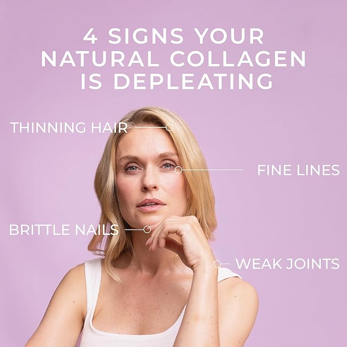 Swedish Collagen - Hydrolyzed Marine Collagen 10,000 mg Powder Supplement - Pack of 300 g, 30 Day Supply | Pure Peptide for Healthy Hair, Skin, Nails & Joints I 100% Natural & Gluten Free | Sugar-Free