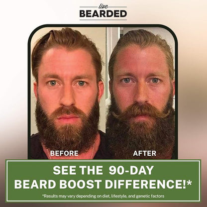 Live Bearded Beard Boost - Hair Growth Multivitamins with Biotin 10,000mcg, Vitamins C, E and Zinc - Thick, Strong, Full Grow Support - Made in The USA | 60-Day Supply