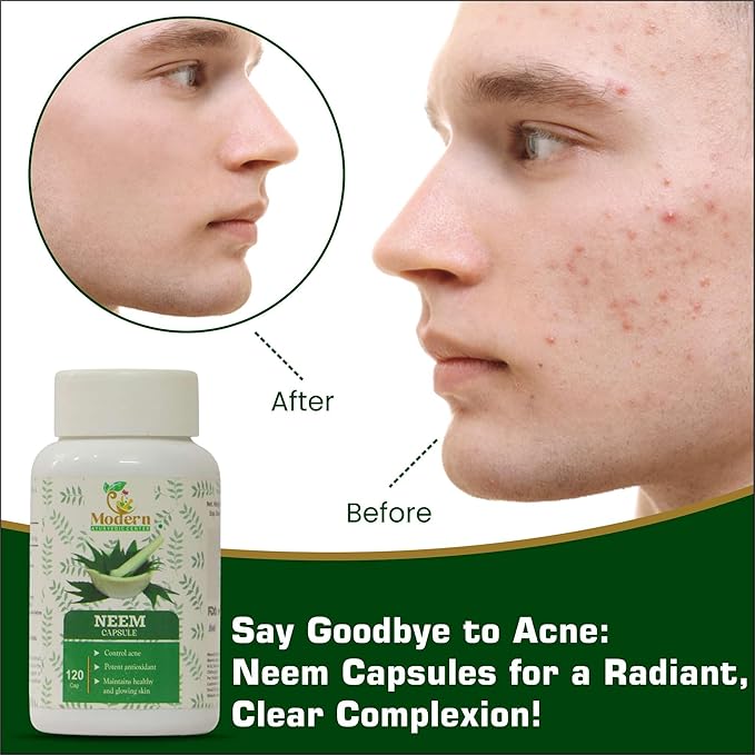 Modern Ayurvedic Center Organic Neem 120 Capsules Supports Acne Control, Antioxidant Protection, Healthy & Glowing Skin Pure Neem (Azadirachta Indica) Supplement for Natural Wellness