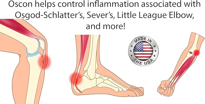 Oscon 60 ct - RRR-a-tocopherol & Selenium Nutraceutical Supplement