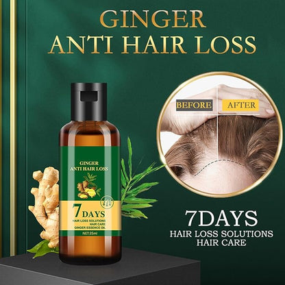 2Pcs Lidoria Ginger Anti Hair Loss 7 Days,Ginger Anti Hair Loss 7 Days (2pcs)