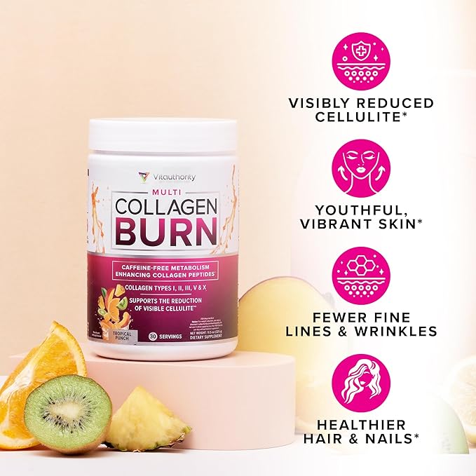 Vitauthority Collagen Peptides Powder Weight Loss Supplements | Hydrolyzed Beauty Complex for Women, Hair Skin Nails | Fat Burning Support | Chocolate Flavored 25 Servings