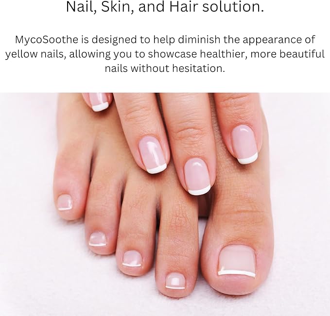 MycoSoothe Advanced Hair, Skin, Nail & Immunity Support Formula - 60 Capsules