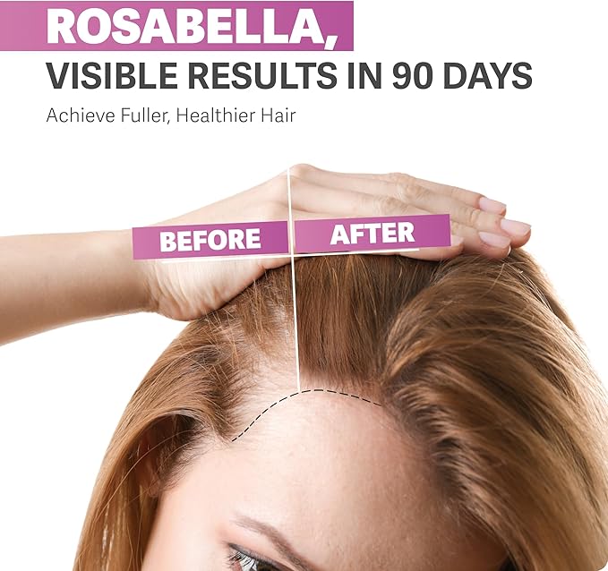 Rosabella Hair Growth Gummies for Women & Men – Vegan Hair Gummies with 5000mcg Biotin – Hair Vitamins for Strong, Healthy-Looking Hair – Gummy Biotin Supplement – 60 Count