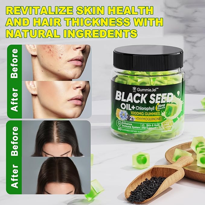 Black Seed Oil Gummies & Chlorophyll, Biotin 500mcg with Hydrolyzed Collagen, Raw Manuka Honey, Organic Cold Pressed - Ultimate Absorption for Skin, Hair & Nails, Digestive, Overall Health, Sugar Free