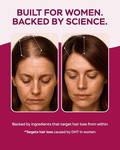 Improved Complex Saw Palmetto for Women Wellness with DHEA Supplement and Collagen Peptides 900mg - Advanced Formula for Hair Skin and Nails - Vitamins & DHT Blocker for Women Hair Growth 60 Capsules