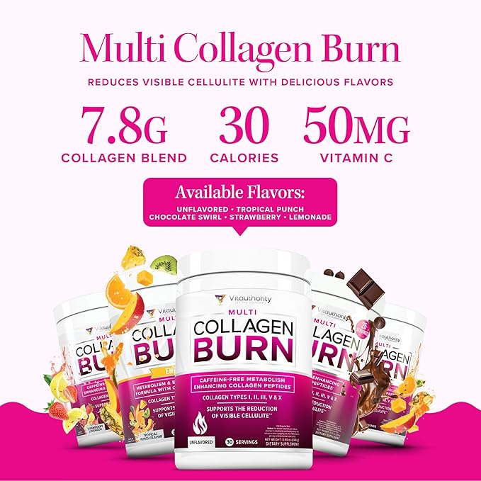 Vitauthority Collagen Peptides Powder Weight Loss Supplements | Hydrolyzed Beauty Complex for Women, Hair Skin Nails | Fat Burning Support | Chocolate Flavored 25 Servings