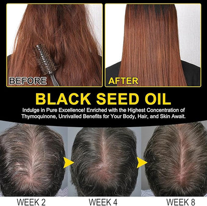2 Pack Black Seed Oil Organic Cold Pressed,100% Pure & Natural Liquid Black Seed Oil Cold Pressed Glass Bottle 60ML for Skin Cares, Nourishes and Hydrates Hair