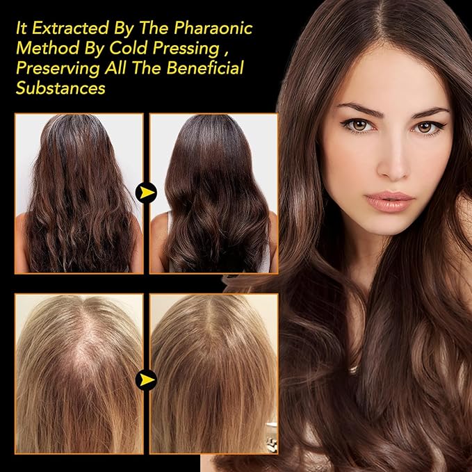 Black Seed Oil Organic Cold Pressed, 100% Pure and Natural Liquid, Enriched with High TQ & Dynamic Harmony of Omegas 3 6 9, Hair Growth, Skin Cares, Nourishes and Hydrates Hair
