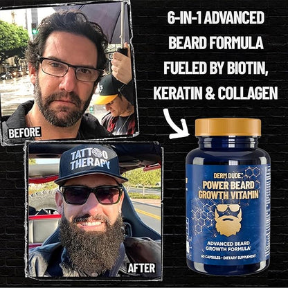 Derm Dude Power Beard Growth Vitamins for Men | With Biotin 10K MCG, Zinc B12 Saw Palmetto & Keratin for Healthier Thicker Fuller & Stronger Facial Hair | Restore Hair Breakage & Thinning, 60 Capsules