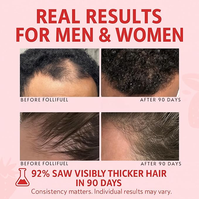 Follifuel Hair Growth Powder Drink Mix for Women & Men | 3-in-1 Hair, Gut & Energy Support | Biotin, Zinc, Caffeine & Saw Palmetto | Hair Vitamins for Thinning Hair | Strawberry Lemonade | 30 Servings