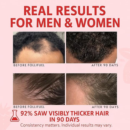 Follifuel Hair Growth Powder Drink Mix for Women & Men | 3-in-1 Hair, Gut & Energy Support | Biotin, Zinc, Caffeine & Saw Palmetto | Hair Vitamins for Thinning Hair | Strawberry Lemonade | 30 Servings