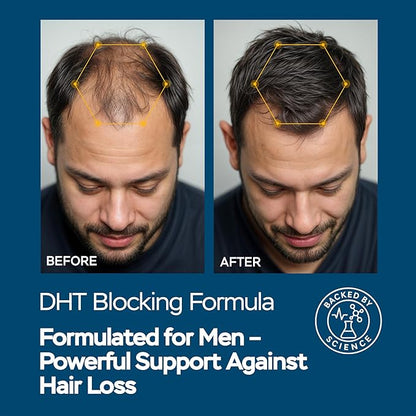 Improved Complex Saw Palmetto for Men & Prostate Health Supplements for Men - Advanced Formula Saw Palmetto Extract w/ DHEA & Ashwagandha 900mg - DHT Blocker for Hair Support - Prostate Supplements