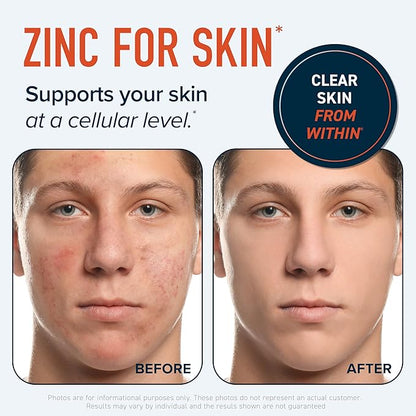 Zinc Supplement Microbeadlets for Immune & Acne Support | Highly Absorbable Zinc Bisglycinate & Orotate with 2mg Chelated Copper + Vitamin B6 | Vegan, Gluten-Free | 60 Capsules (2 Month Supply)